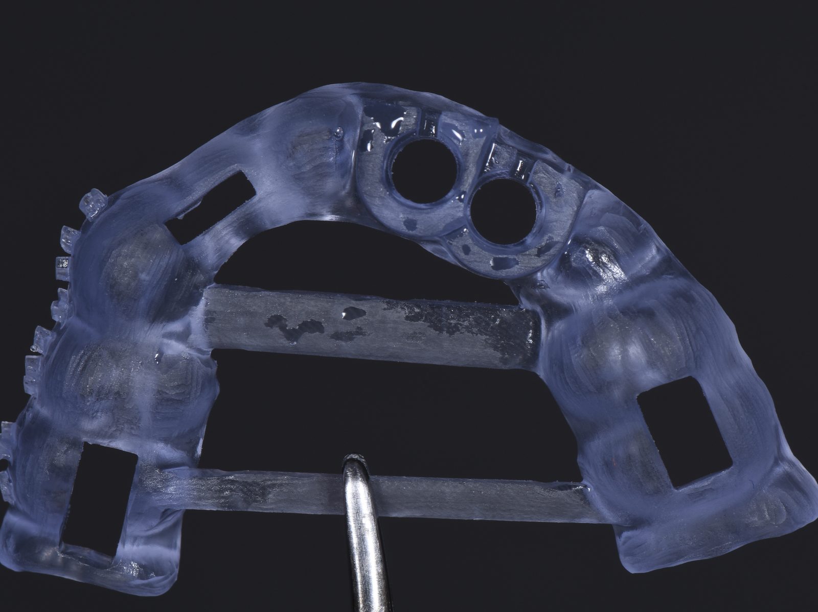The printed tooth-supported template with two guide sleeves and inspection windows