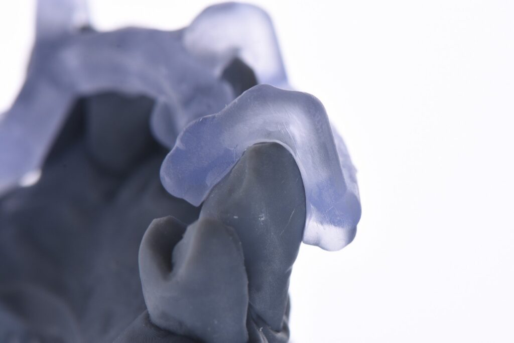 The template seated over a printed model, engaging the abutment tooth