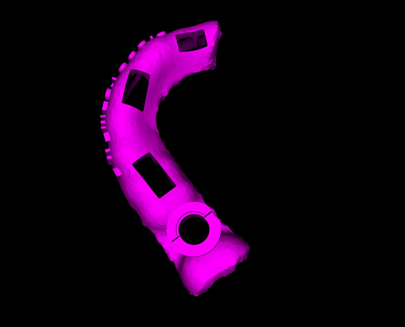 The tooth-supported surgical template designed around site 16