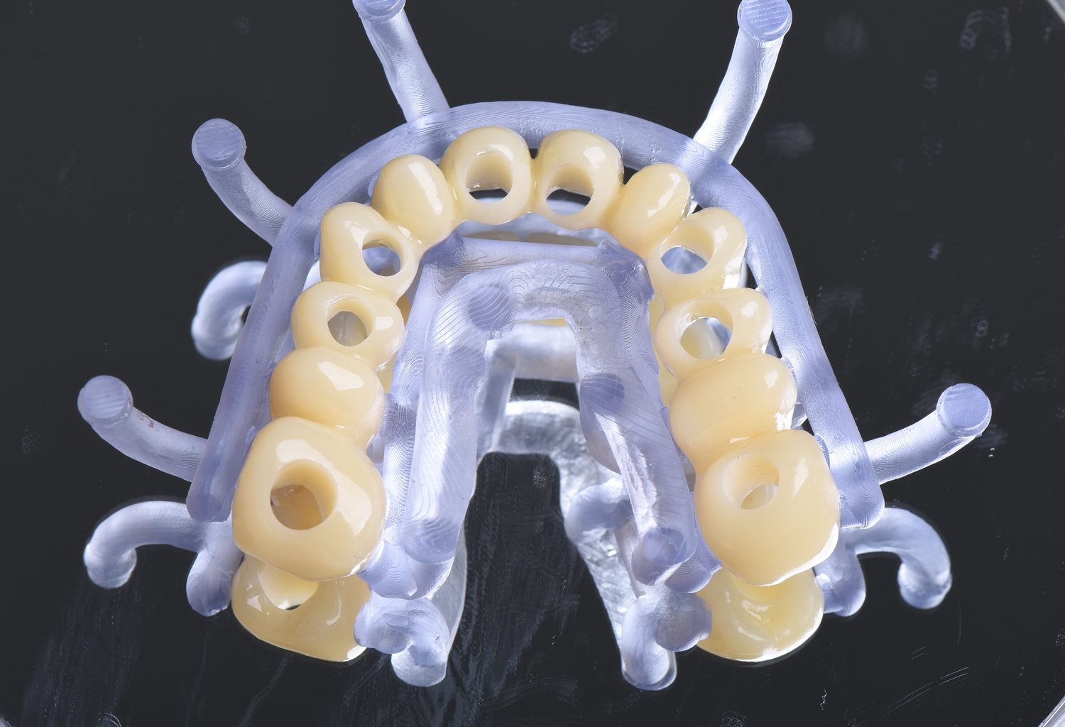 The provisional guide with the prosthetic teeth in position