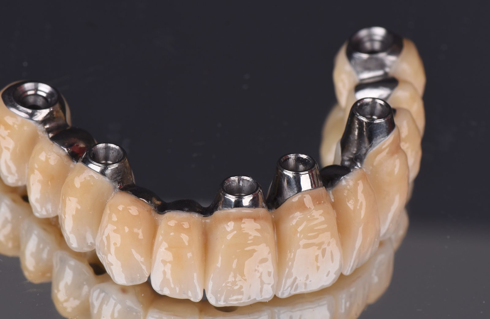 The definitive screw-retained implant bridge photographed off the mouth, showing the abutment interfaces